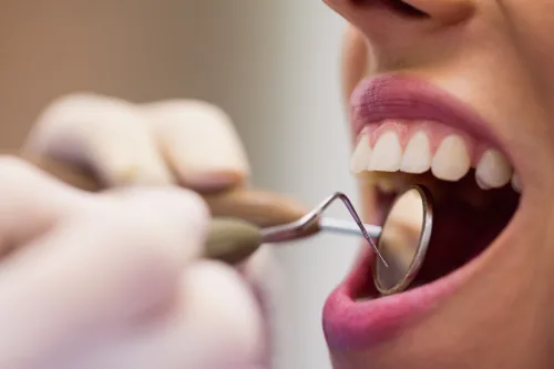 Discover Exceptional Implant in Bristol Solutions with Trusted Optima Dental Bristol PA for Confident Healthy Smiles