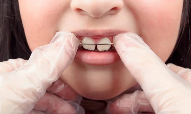 Personalized care for children from a pediatric orthodontist