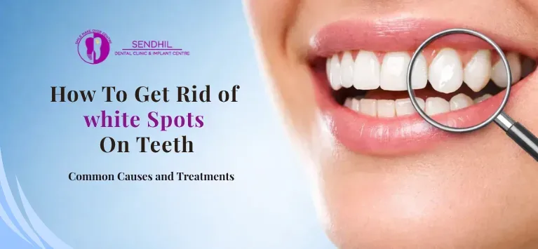 How to Get Rid of White Spots on Teeth