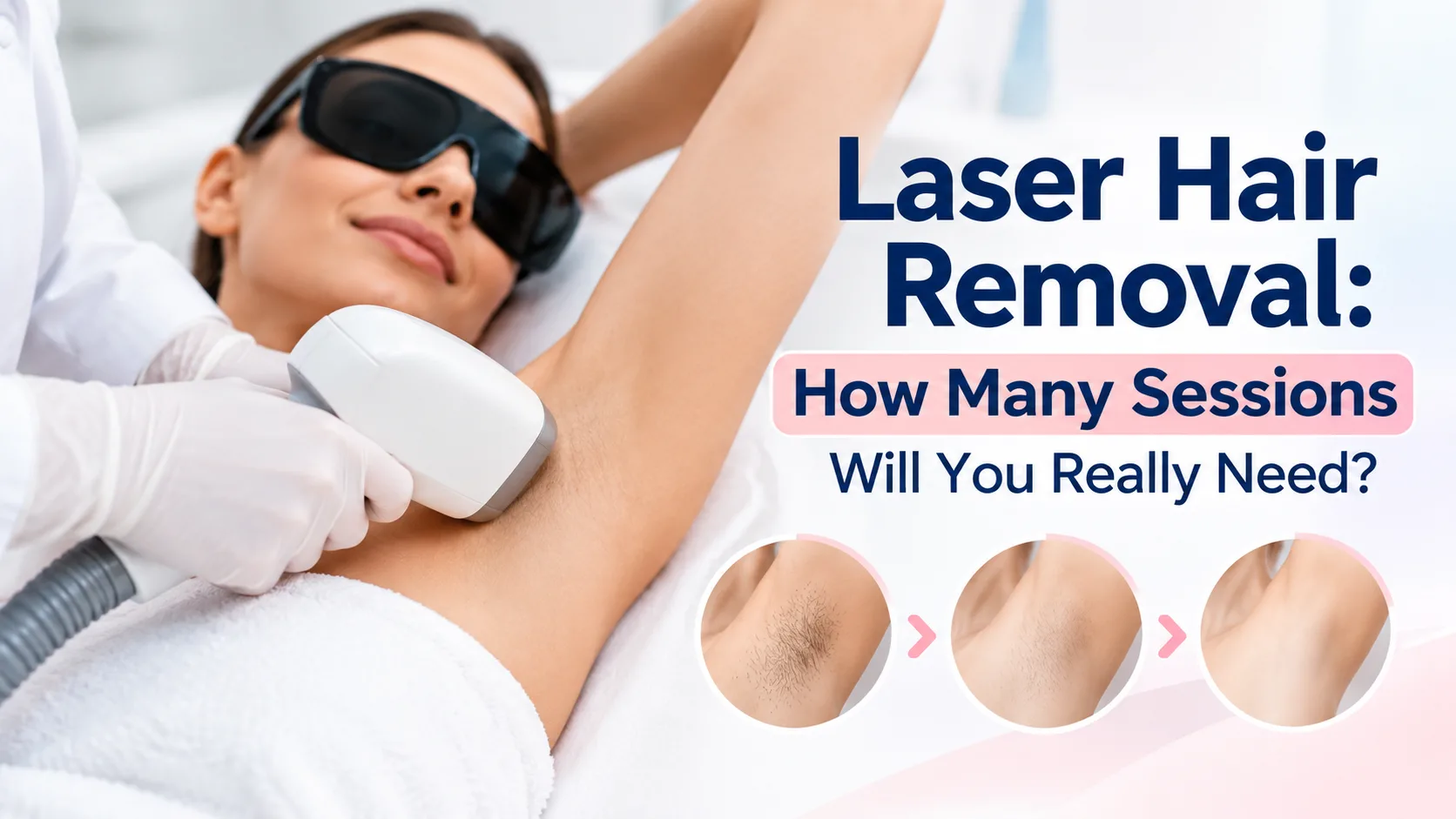 Laser Hair Removal: How Many Sessions Will You Really Need?