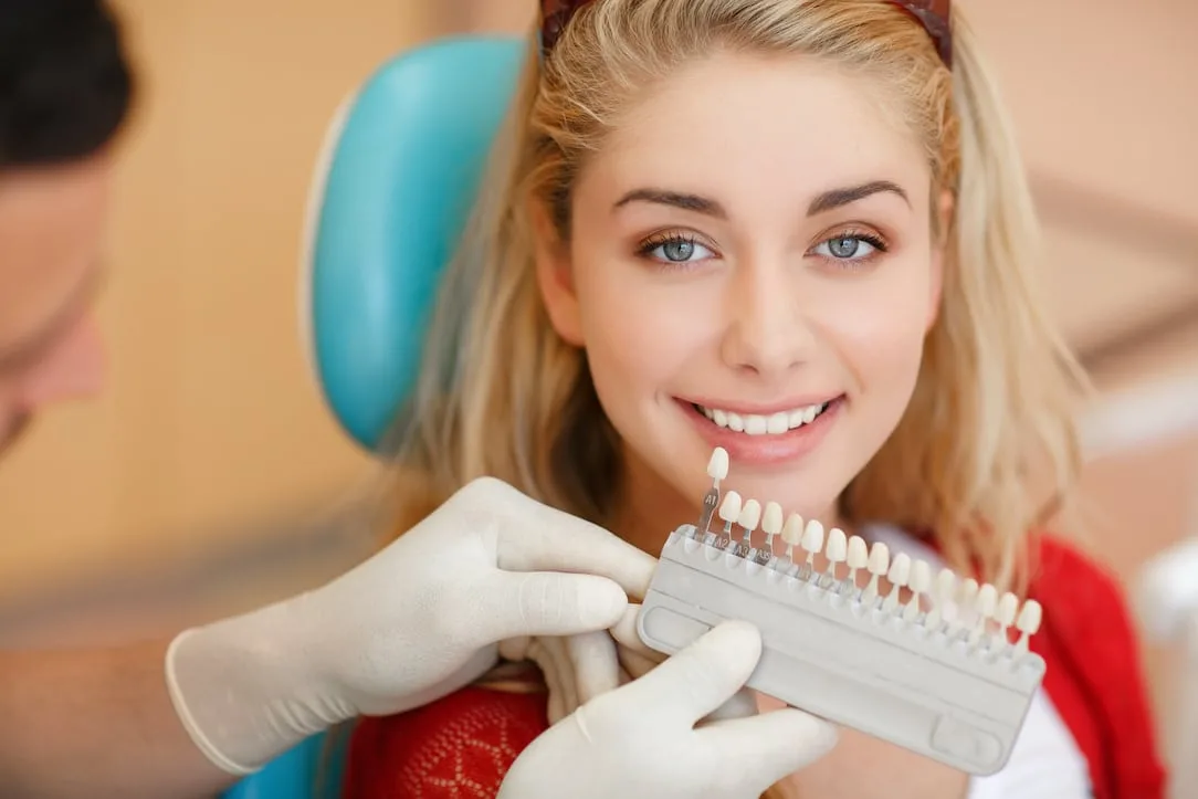 Everything You Should Know About Dental Veneers