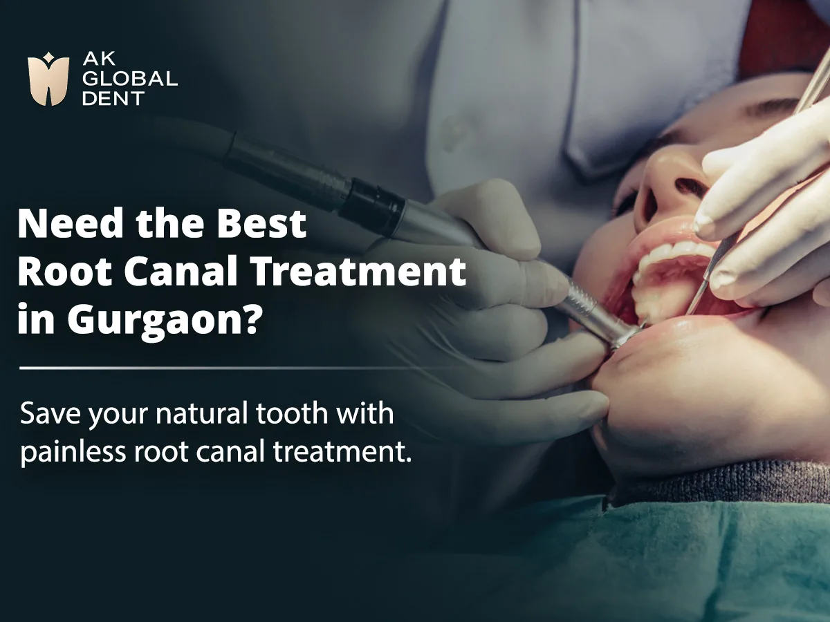 Why Toothache Should Never Be Ignored: A Simple Guide for Patients in Gurgaon