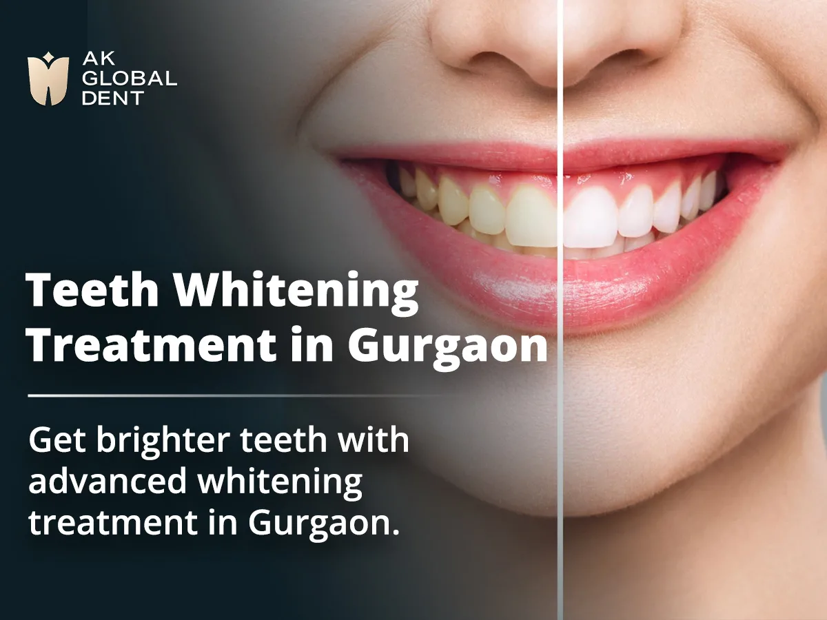 Why a Bright Smile Matters More Than You Think
