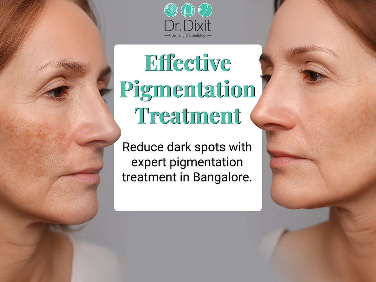 How Does Chrome Quanta Technology Help in Pigmentation Management?