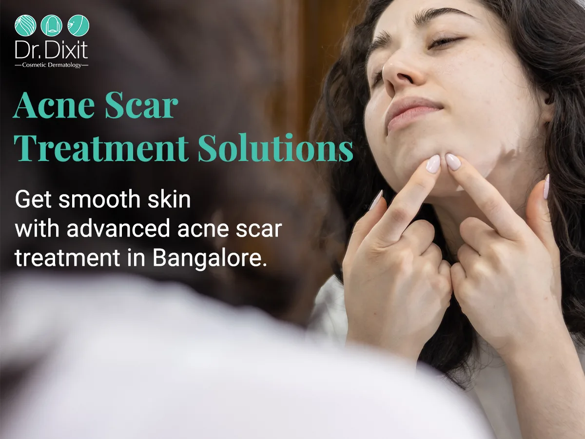 Why Your Acne Is Gone, but the Scars Remain: Understanding Long-Term Acne Scarring