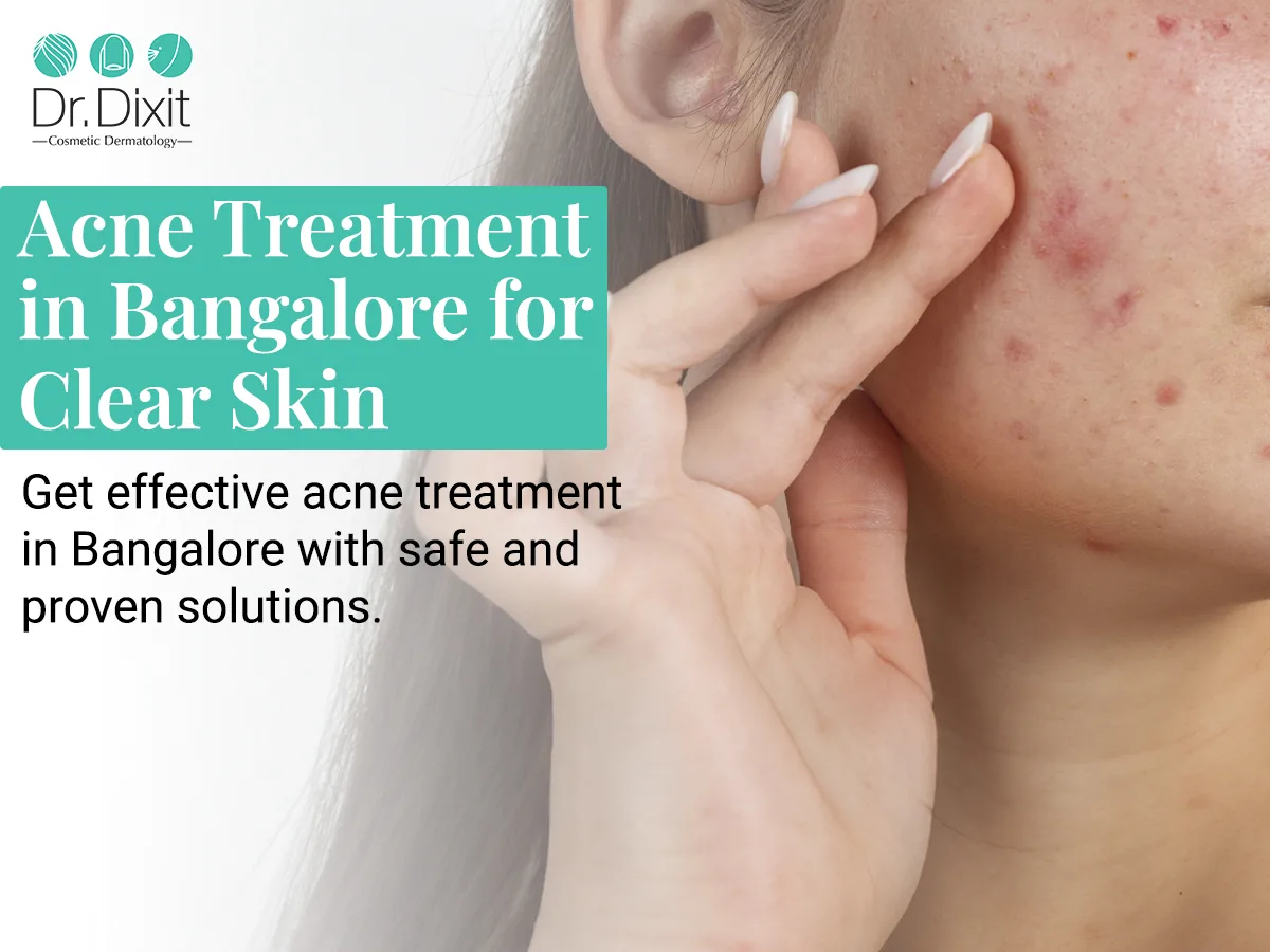 Why Do Some Acne Scars Need More Than One Treatment?