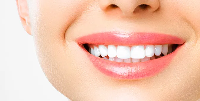 Can I smoke after teeth whitening | Periodonta