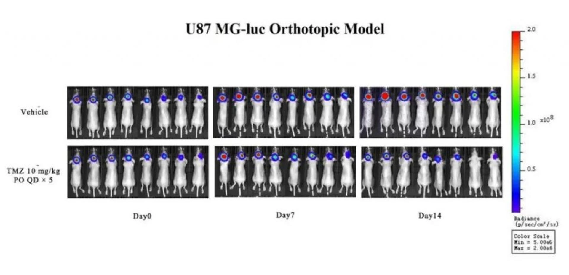 Orthotopic brain transplantation