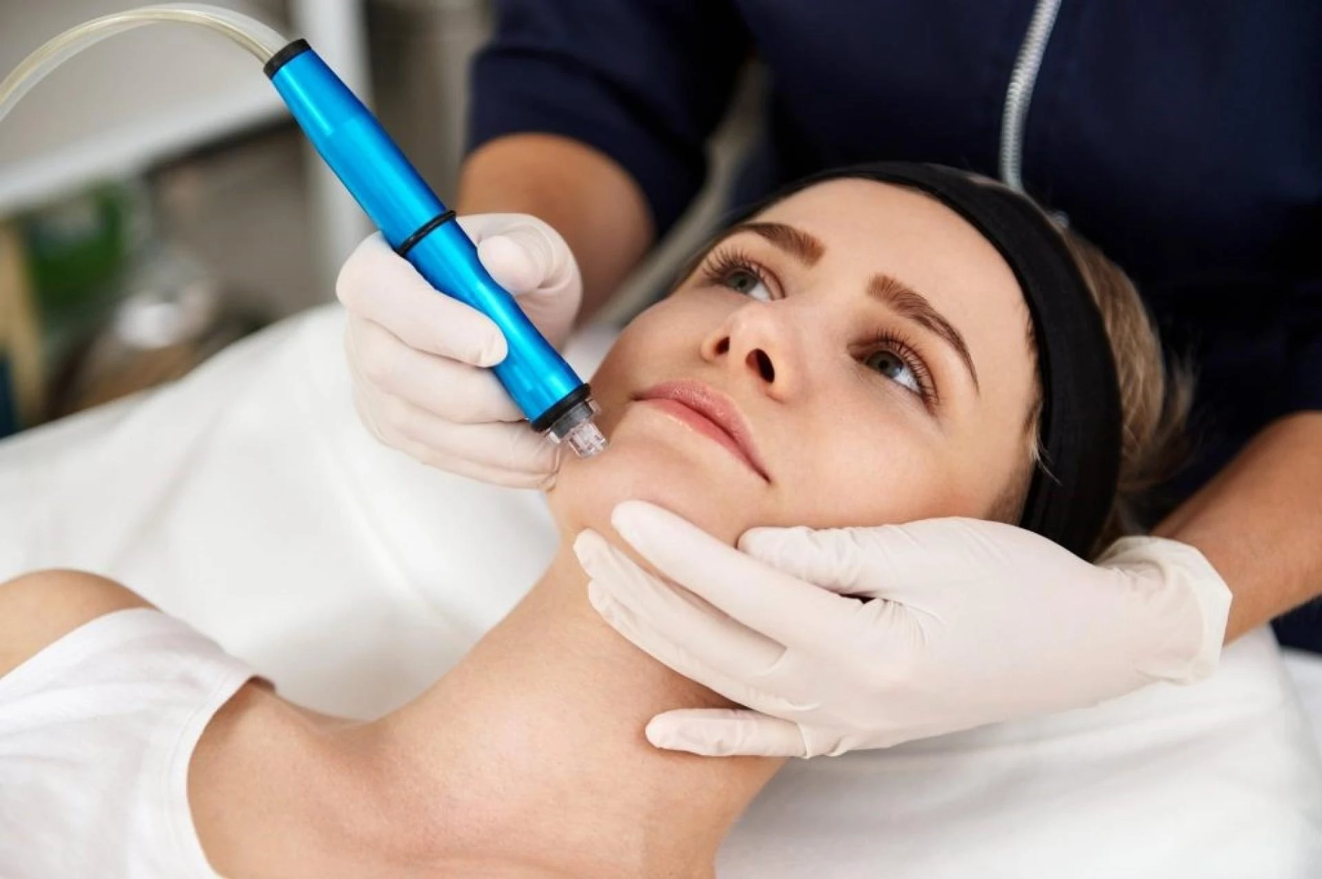 A woman getting a microneedling treatment.