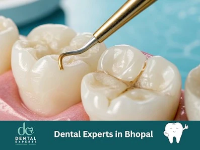 Dental Implant Specialist in Bhopal for Advanced Tooth Replacement