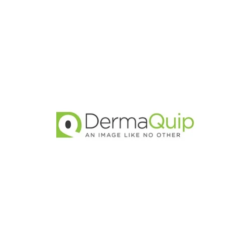 DermaQuip