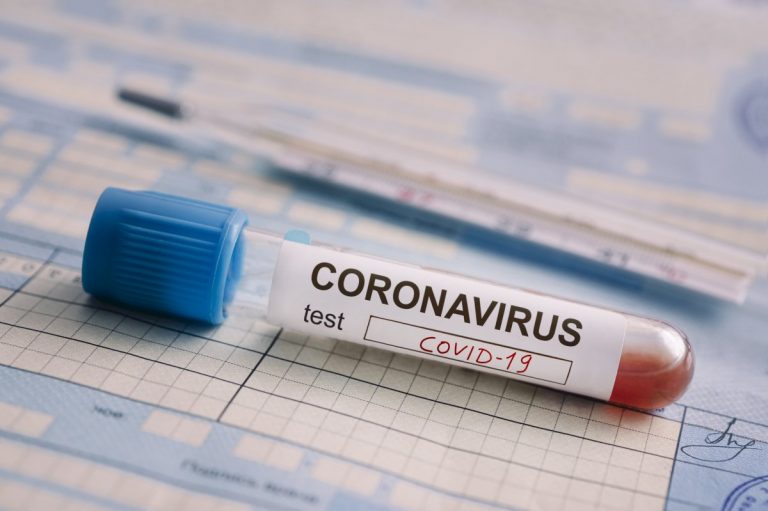 An At-Home Coronavirus Test May Be On the Way in the U.S.