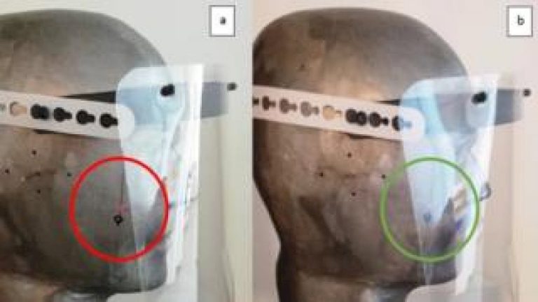 Coronavirus: A4-sized face shields ‘too narrow’ for PPE