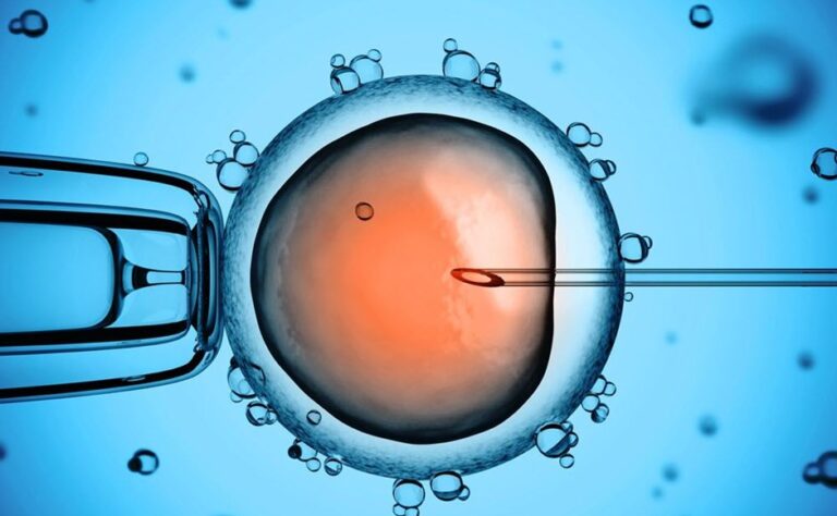 Everything You Need to Know About Intracytoplasmic Sperm Injection