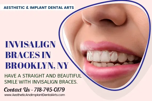 Invisalign Braces and Porcelain Veneers in Brooklyn NY