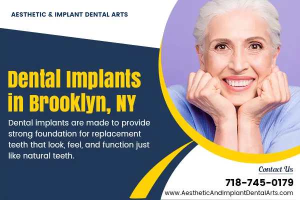 Know About the Various Benefits of Dental Implants