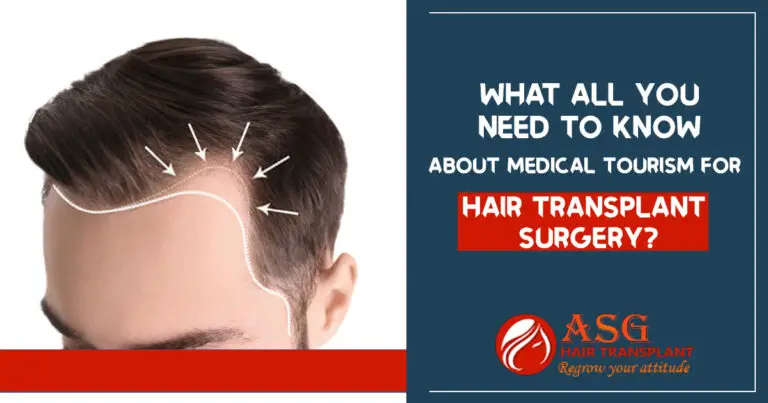 What are the top things you need to know about hair transplant surgery?