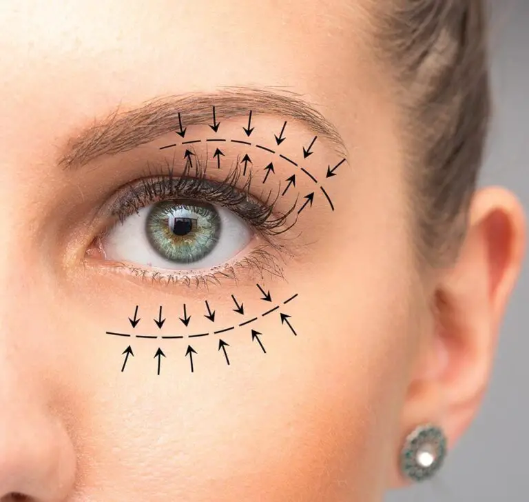 Is an eyelid lift worth it?