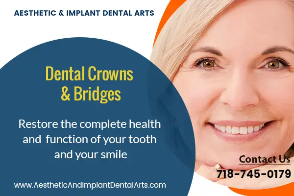 Crowns and Bridges – Major Dental Surgery Procedures