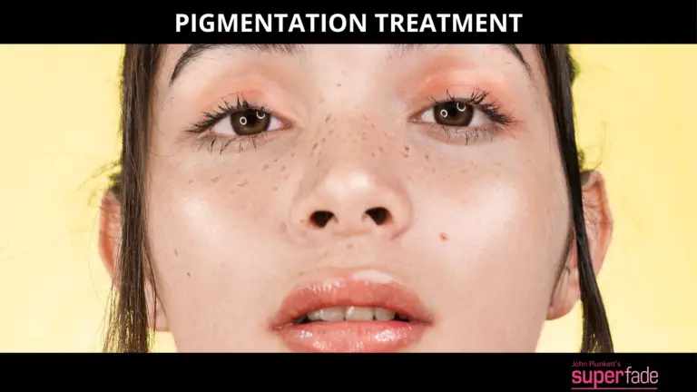 The Role Of Face Pigmentation Cream In Reducing Pigmentation