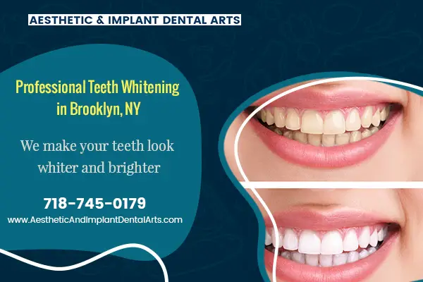 Is A Home Teeth Whitening Kit Right Option For You?