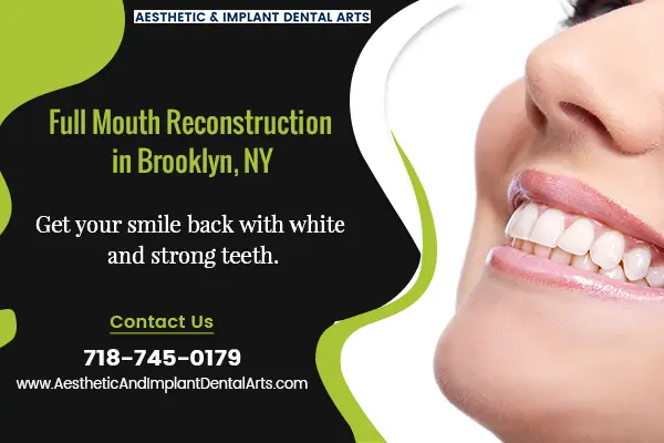 What Do You Need To Know About Full Mouth Reconstruction?