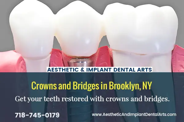What Are The Uses And Benefits Of Dental Crowns?
