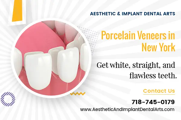 What Dental Flaws Can Porcelain Veneers Solve?