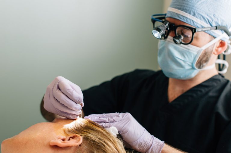 Hair Transplant Surgery: Methods And Benefits