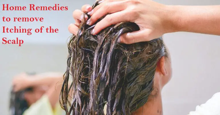 Home Remedies to remove Itching of the Scalp