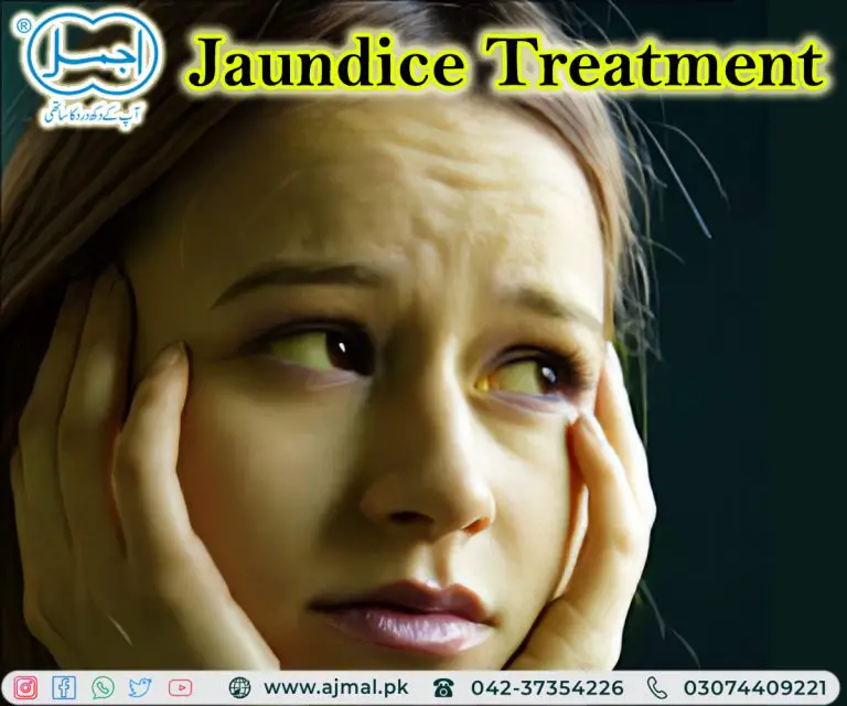 Finding the Best Herbal Treatment for Jaundices