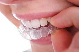 Dentist Calgary NW – Orthodontic Services – Invisalign