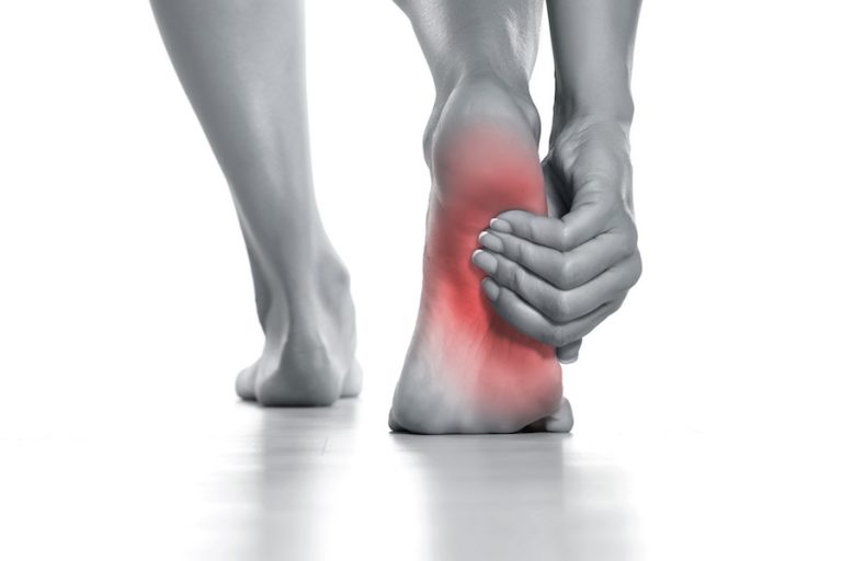 Heel Pain & Plantar Fasciitis Treatment in Houston, TX