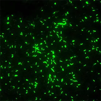 Fluorescent Antibody Technique (Direct, Indirect)