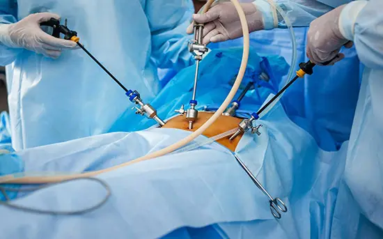 Is Laparoscopy Surgery Advantageous? Learn Here How