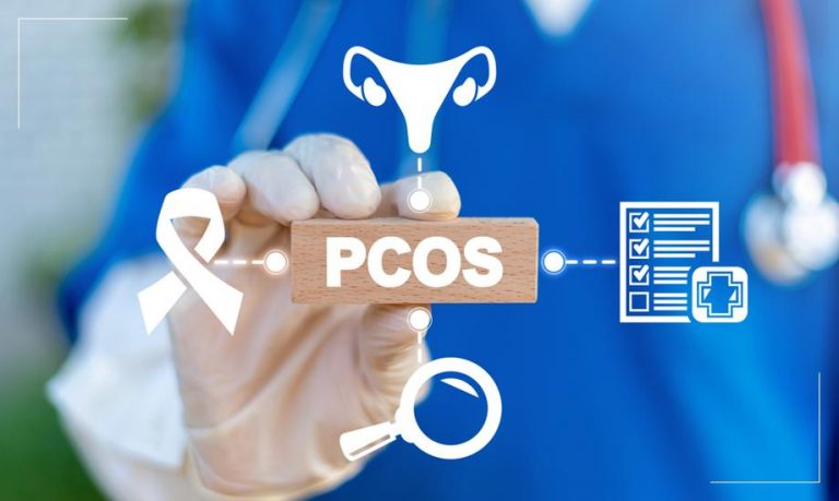 Relieve Symptoms of Polycystic Ovary Syndrome