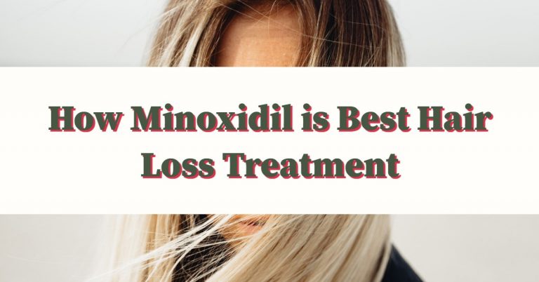 How Minoxidil is Best Hair Loss Treatment