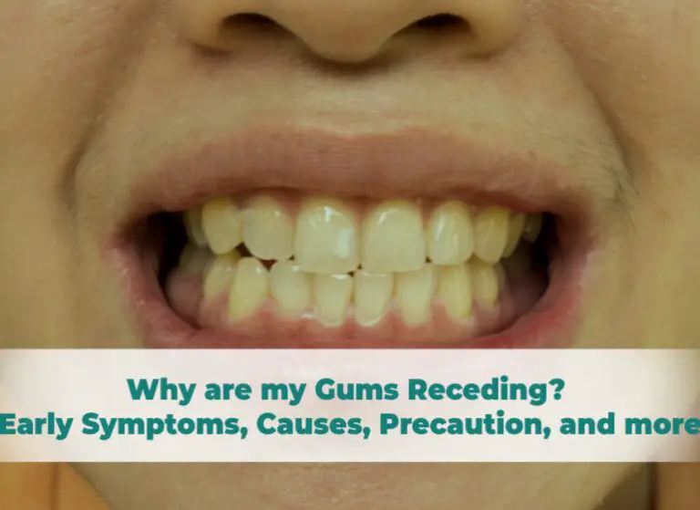 Why are my gums receding?