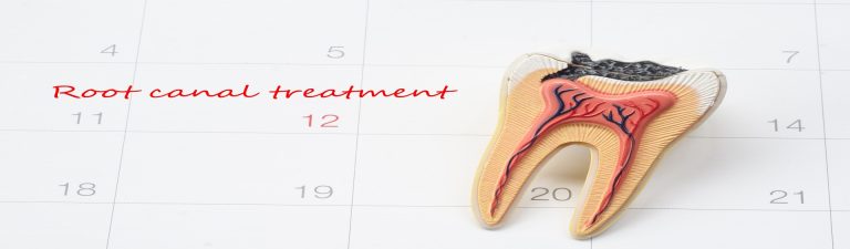 Root Canals And Dental Health: Are You Looking For The Best Root Canal Treatment In Gurgaon?