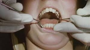 Tooth replacement or repairing option for a broken or chipped tooth