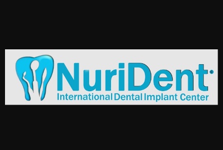 Rumored Buzz on Dental Implants