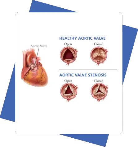 Preventive Cardiac Testing in california