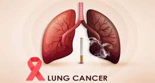 What are the Different Types of Lung Cancer?