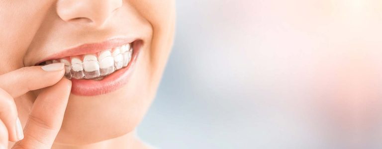 Best Dental Clinic For Braces Near Me