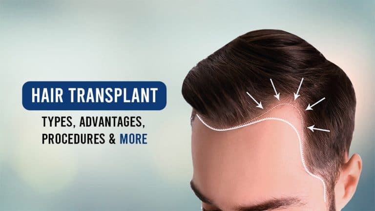 Hair Transplant, Is That This Something You Require?