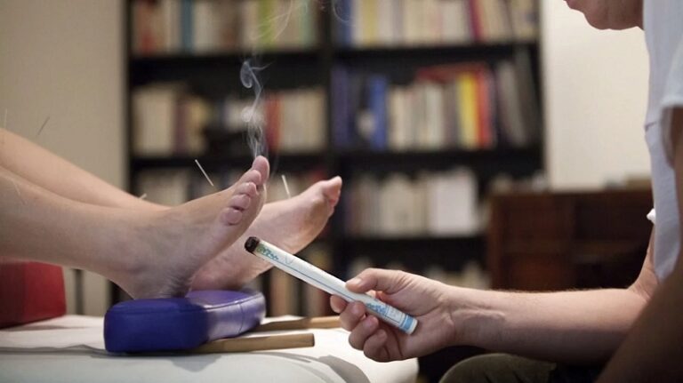 Things you should know about Moxibustion