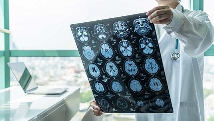 8 Reasons it’s Time to Visit a Neurology Center