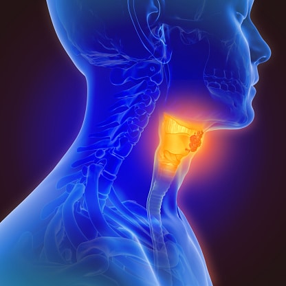 Head and Neck Cancer Market Scope, Economic Impact and SWOT Till 2027