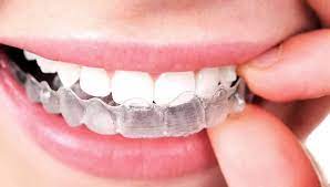 Invisalign Vs Braces – The Pros & Cons Of Each