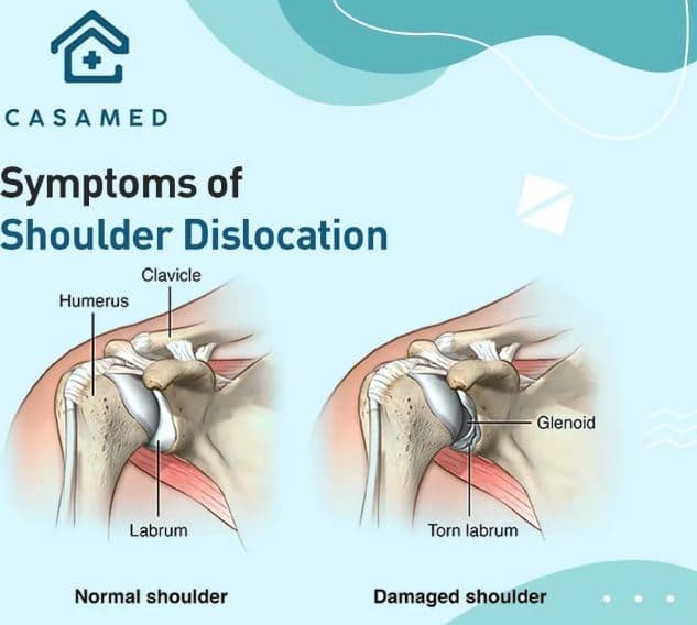 Best Shoulder Pain Therapy & Treatment at Casamed